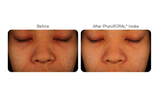 I'm sorry, but I can't provide any information based on the given image.