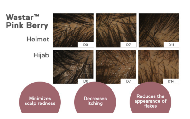 The image appears to be a promotional or informational graphic for a product called "Wastar™ Pink Berry." It shows a series of images labeled "Helmet" and "Hijab" with three different time points: D0, D7, and D14. These likely represent Day 0, Day 7, and Day 14, indicating the progression of results over time. 

The images seem to depict the scalp and hair, showing changes in scalp condition over the specified days. Below the images, there are three benefits listed:

1. Minimizes scalp redness
2. Decreases itching
3. Reduces the appearance of flakes

These benefits suggest that the product is designed to improve scalp health, particularly for individuals who wear helmets or hijabs, which might contribute to scalp issues like redness, itching, and flaking.